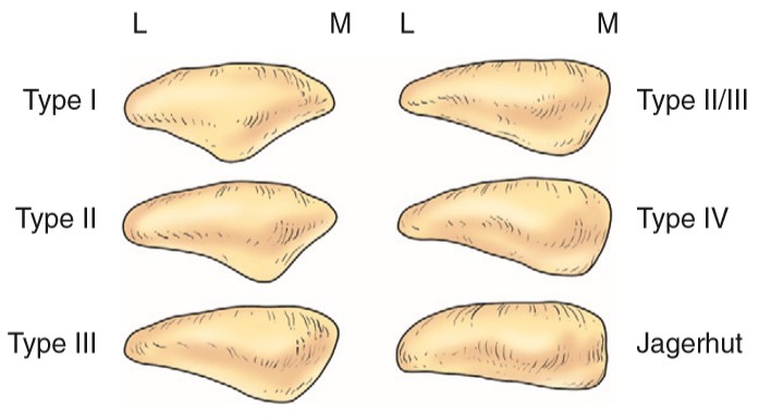 Bony architecture of knee joint- tibia, patella