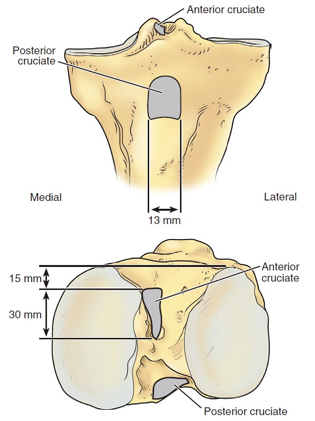 anatomy of the knee joint: cruciate ligament-Anterior Cruciate Ligament ACL