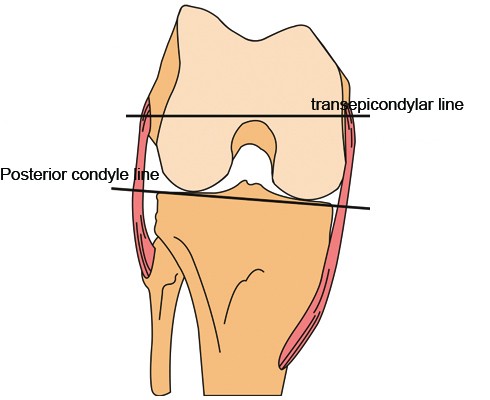 Bone structure of knee joint-femur
